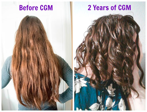 Результаты применения CGM: До и После