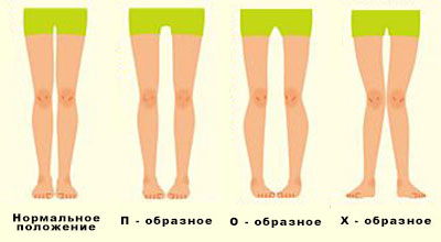 Полные Ножки Женщин Фото